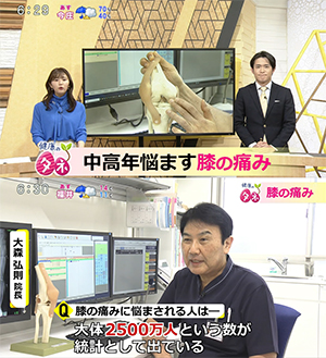 福井テレビ『中高年悩ます膝の痛み』