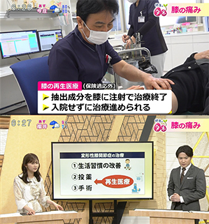 福井テレビ『変形性膝関節症の再生医療』
